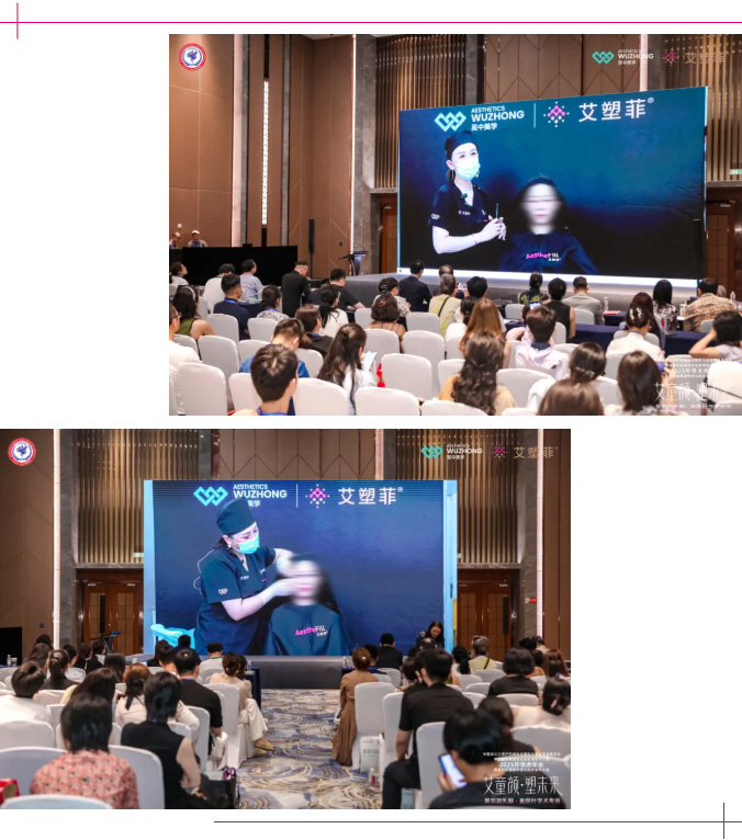 再生医美规范化进程迎新里程碑：艾塑菲®双会擘画PDLLA应用新蓝图_14.jpg